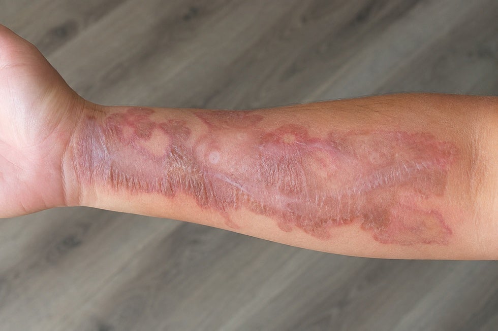 illustrative burn sample from Tatte Coffee