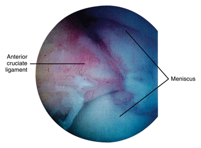 Figure 9: Knee arthroscopy.