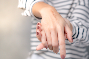Scarring and Disfigurement Injuries