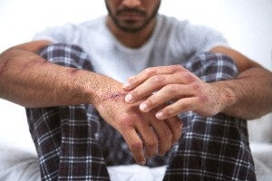 Severe Psychological Injury Attorney