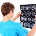 Man holding a brain CT scan result