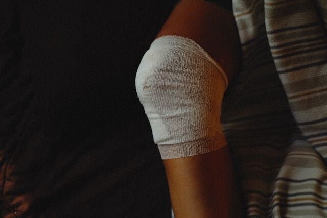 compensation for minor injuries