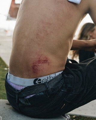 minor injuries basis for filing a lawsuit