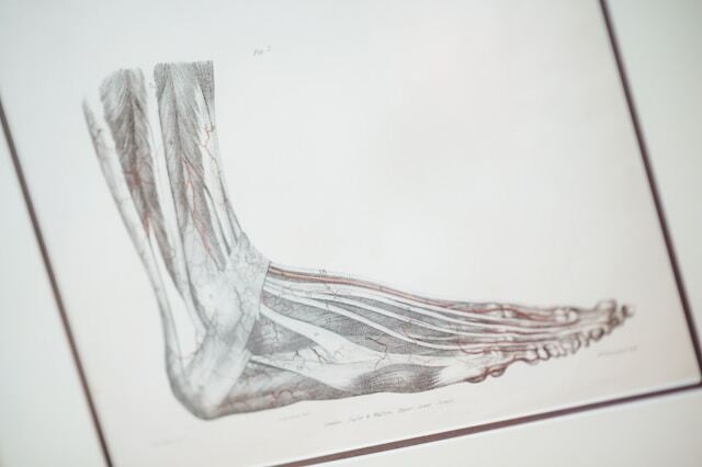 recognizing stress fracture indicators