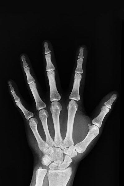 hand personal injury denver co