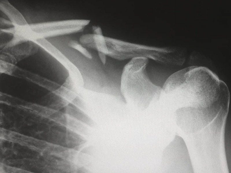 medical malpractice attorney in denver, co