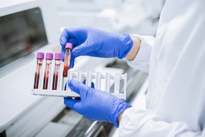 Blood Split Motions in California DUI Cases