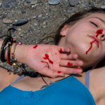Female Minor Injured with nose bleeding
